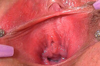 Gape My Pussy Trial Link s2