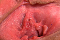 Gape My Pussy Trial Link s3